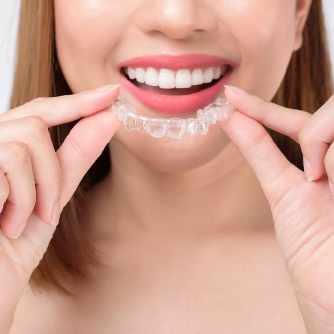 custom invisalign alingners boca